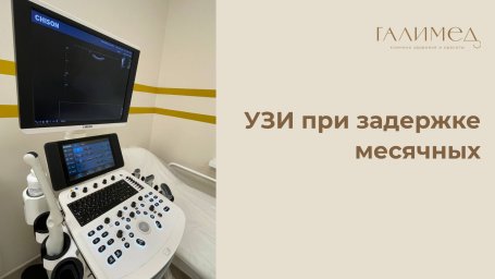 УЗИ при задержке месячных в Балашихе — точная диагностика причины УЗИ при задержке месячных в Балашихе — точная диагностика причины