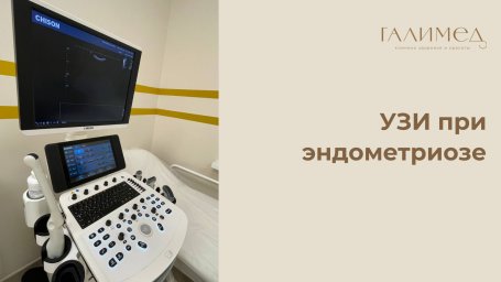 УЗИ при эндометриозе в Балашихе УЗИ при эндометриозе в Балашихе