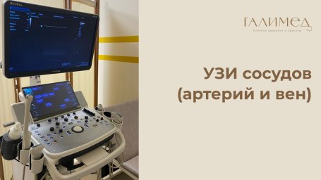 УЗИ сосудов (артерий и вен) в Балашихе &mdash; без очереди, в день обращения
