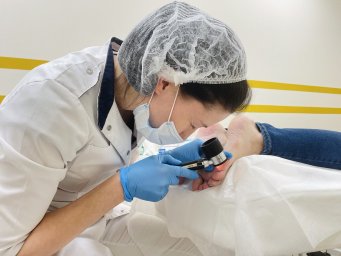 Удаление бородавки в Балашихе Удаление бородавки в Балашихе