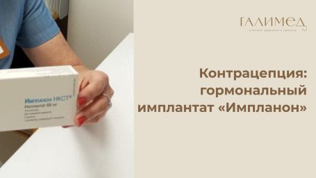 Контрацепция в Балашихе: гормональный имплантат &laquo;Импланон&raquo; &mdash; установка и удаление