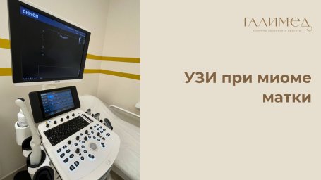 УЗИ при миоме матки в Балашихе — точная диагностика и контроль без очереди УЗИ при миоме матки в Балашихе — точная диагностика и контроль без очереди