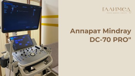 УЗИ на аппарате Mindray DC-70 PRO