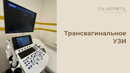 Трансвагинальное УЗИ в Балашихе — точная диагностика без очереди Трансвагинальное УЗИ в Балашихе — точная диагностика без очереди